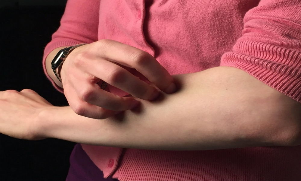 A woman scratching her arm